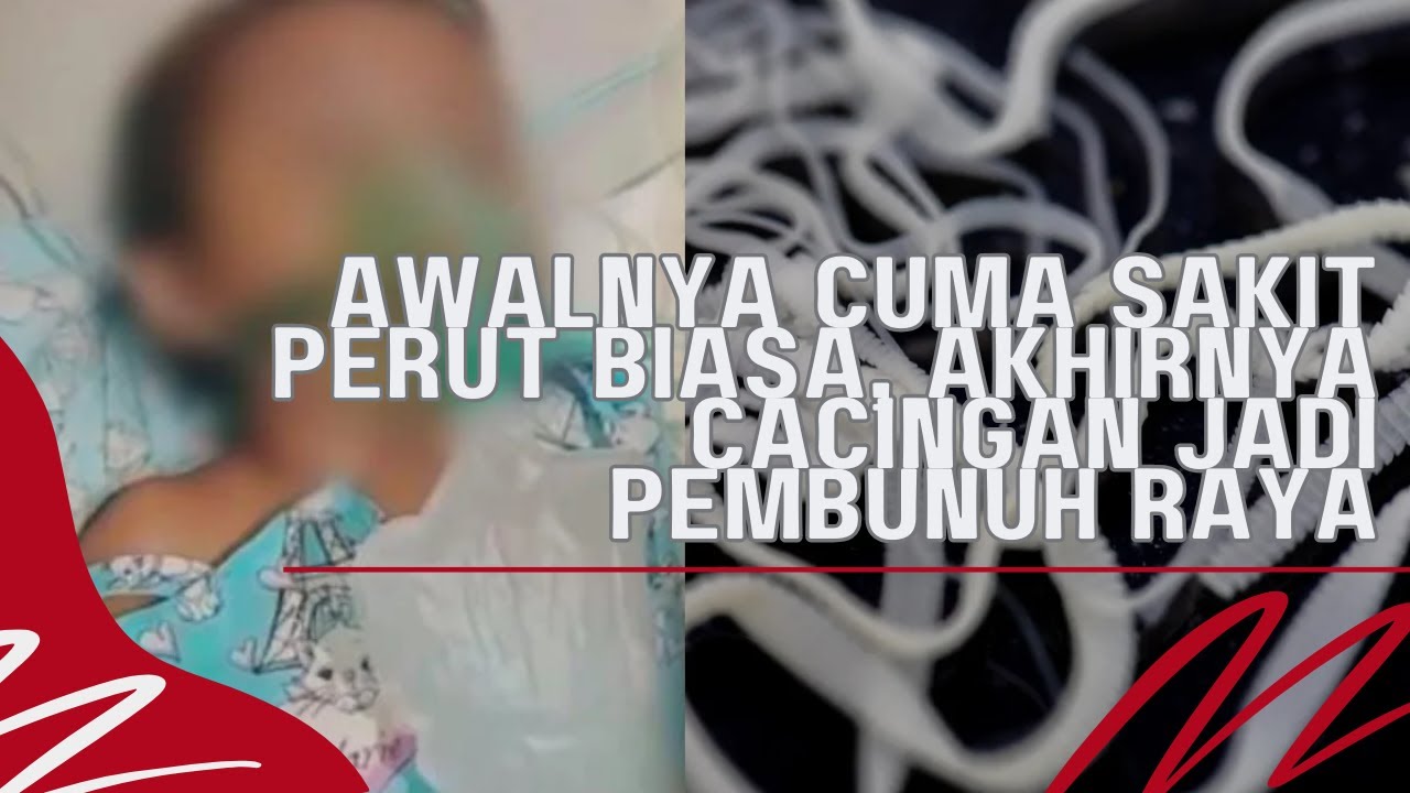 Terlambat Sadar, Cacingan Ternyata Bisa Membunuh Si Kecil Raya #kesehatan #anak #penyakit #cacingan