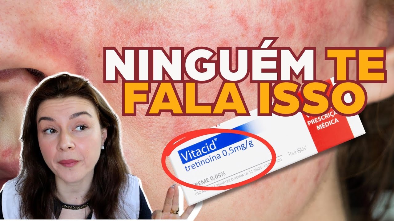 Vitacid: O produto de skincare mais famoso da internet