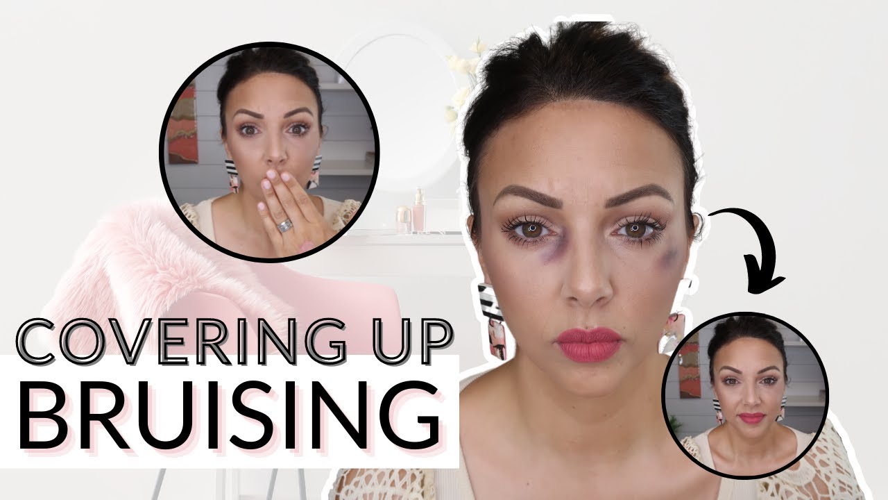 Covering Dark Area with Makeup, Could Amber Heard cover up bruising  | Amber Lykins