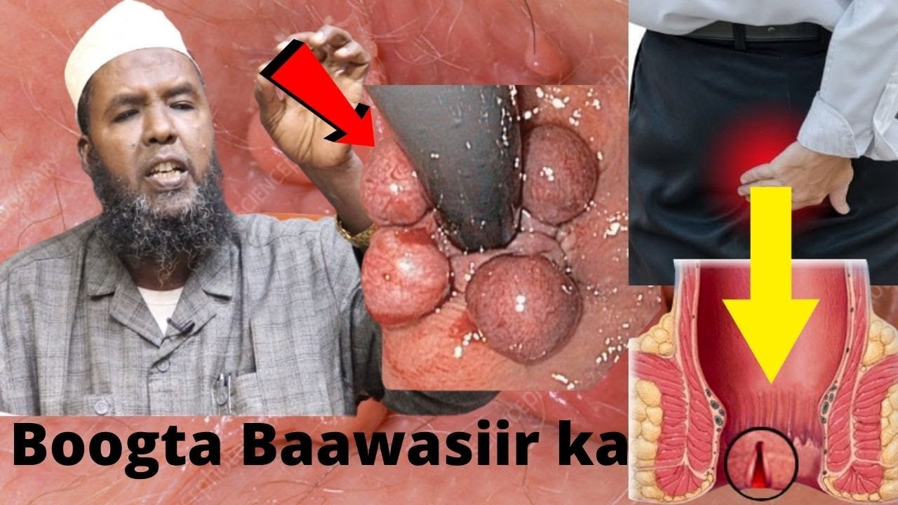 20 Ka Nuuc  Ee BAAWASIIR Ku Yimaado Iyo Wax Yaabaha Sababa (Q.1aad)