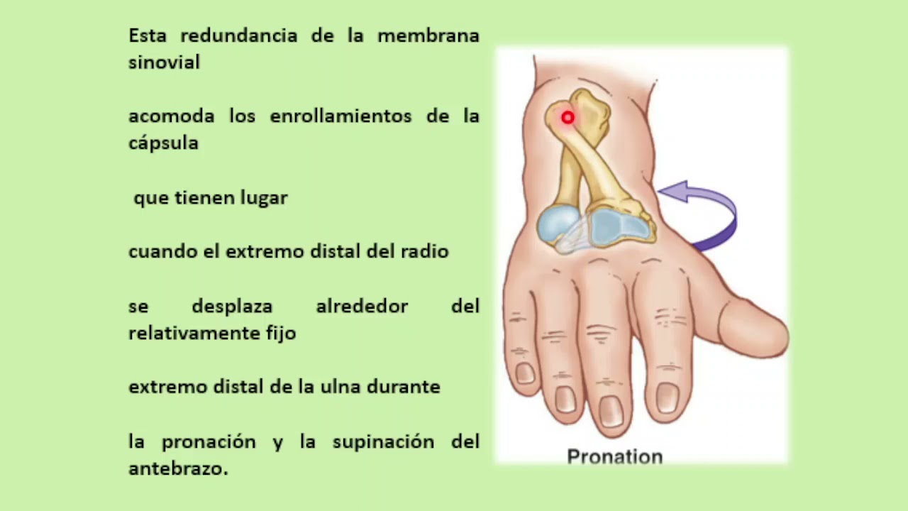 Articulación radioulnar distal