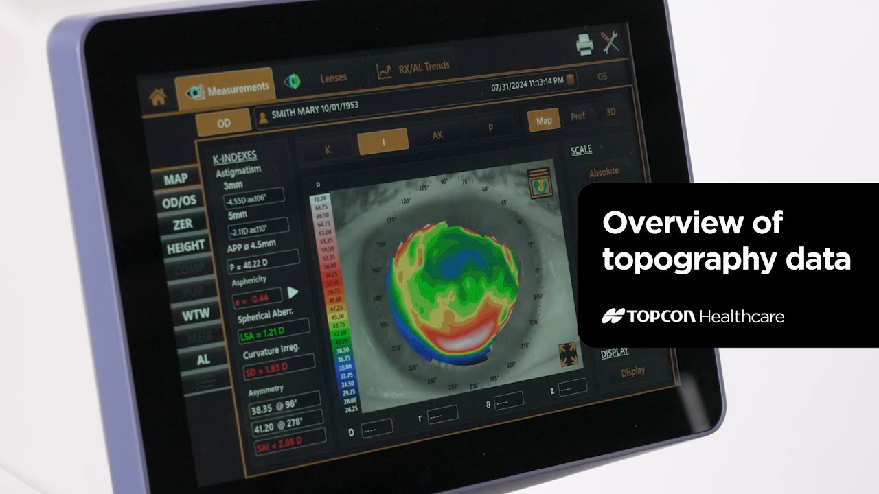 Reviewing topography data captured on the Topcon MYAH