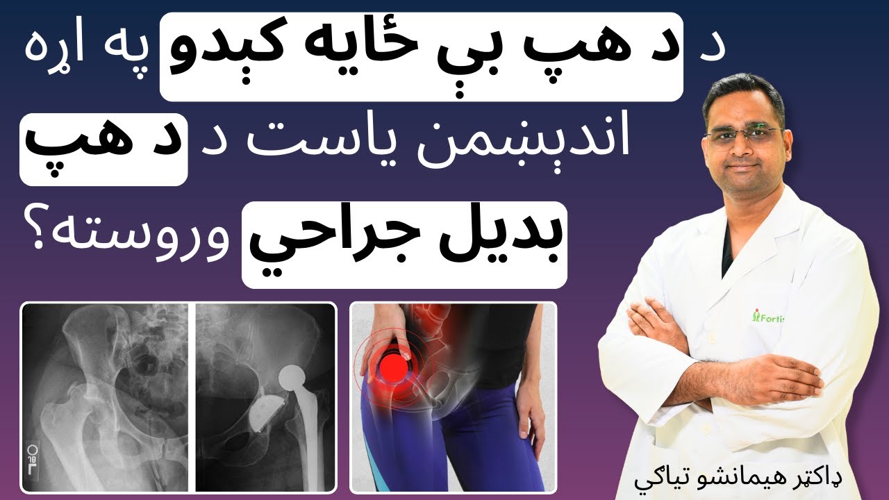 د د هپ بې ځایه کېدو په اړه اندېښمن یاست د د هپ بدیل جراحي وروسته؟ | Hip Replacement  surgery pashto