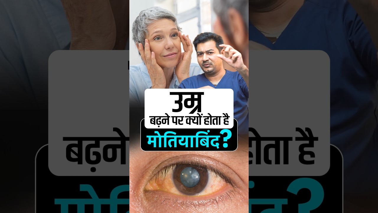 मोतियाबिंद (Cataract) क्यों होता&nbsp;है?