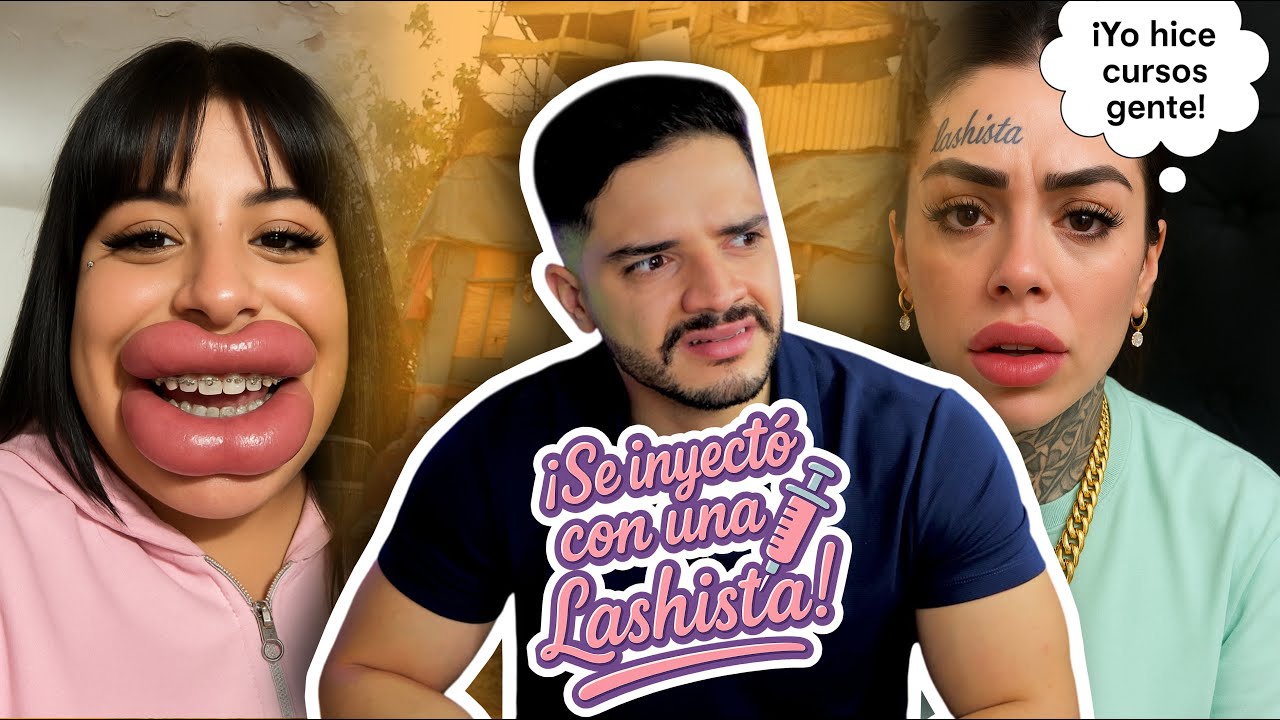 Reaccionando a Coqueta y su inyección de LABIOS con una Lashista