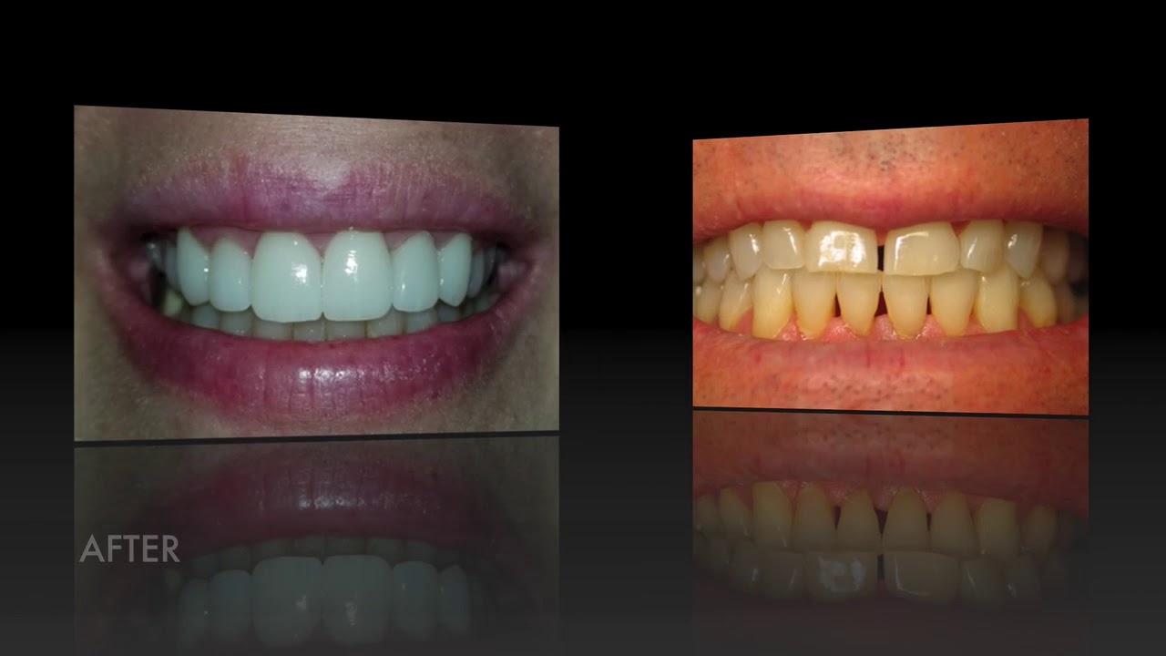 Dr. Rick Dentistry - Before & Afters