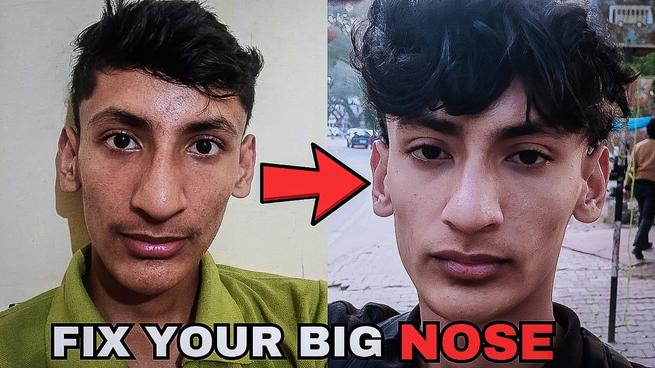 Watch This Video If You Are Suffering From Big Nose👃🏻