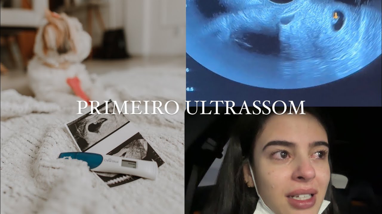 PRIMEIRO ULTRASSOM DO BABY LOURES   !!