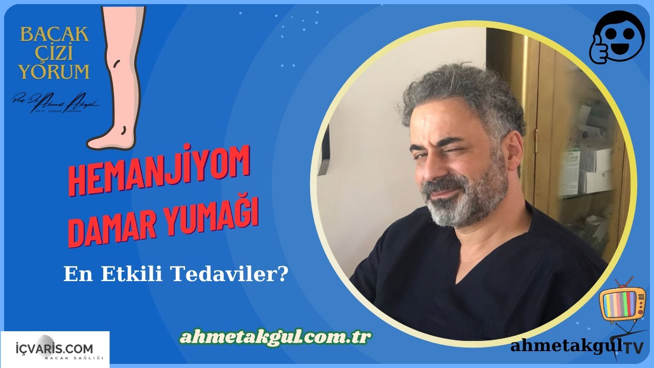 Damar Yumağı / Kas İçinde Venöz Hemanjiyom: En Etkili Tedavi Yöntemleri- Prof. Dr. Ahmet AKGUL