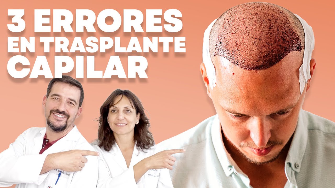 🔵 Injerto capilar: 3 ERRORES a EVITAR ✨