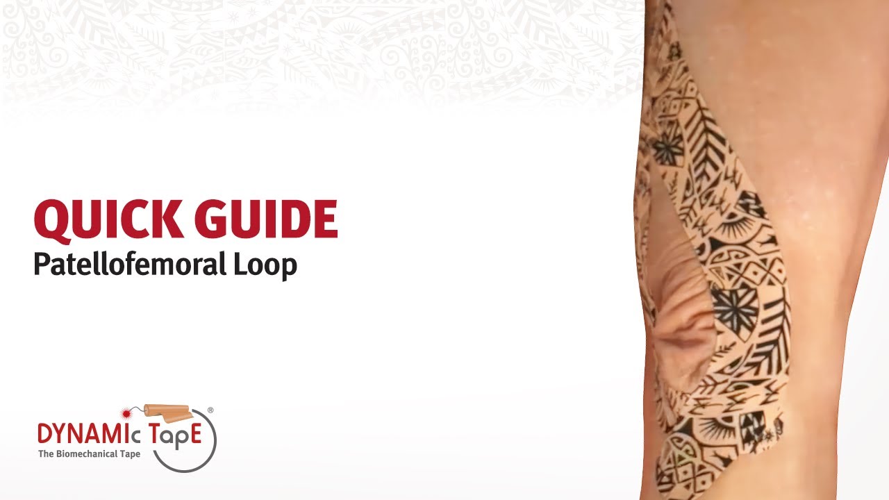 Quick Guide - PF Loop Taping for Patellofemoral Pain, Fat Pad Syndrome & Patellar Instability
