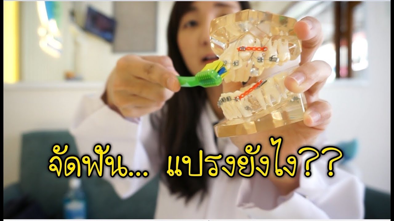 วิธีแปรงฟัน สำหรับคนจัดฟัน by หมอโบว์ ll Bow Dent MU