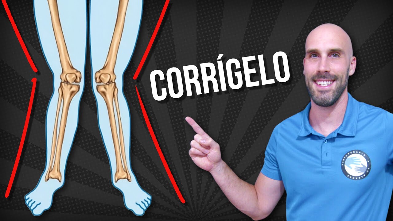 6 EJERCICIOS para CORREGIR LAS RODILLAS EN VALGO
