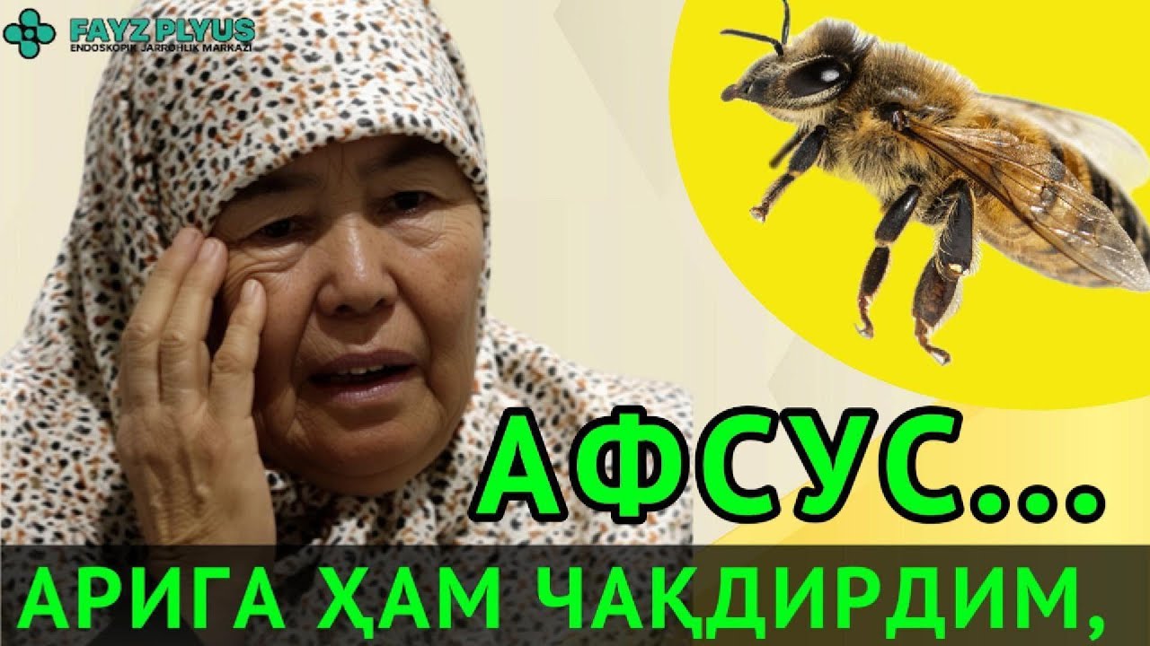 АРИГА ҲАМ ЧАҚДИРДИМ. АФСУС..