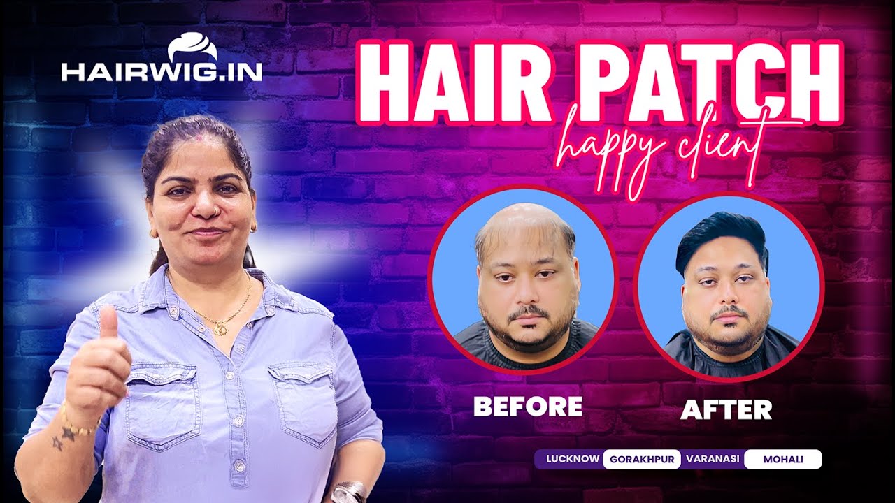 Men Hair Patch |#transformation  #gorakhpur #PinkiSingh #Hairwig #lucknow #trending #viral #hairwig
