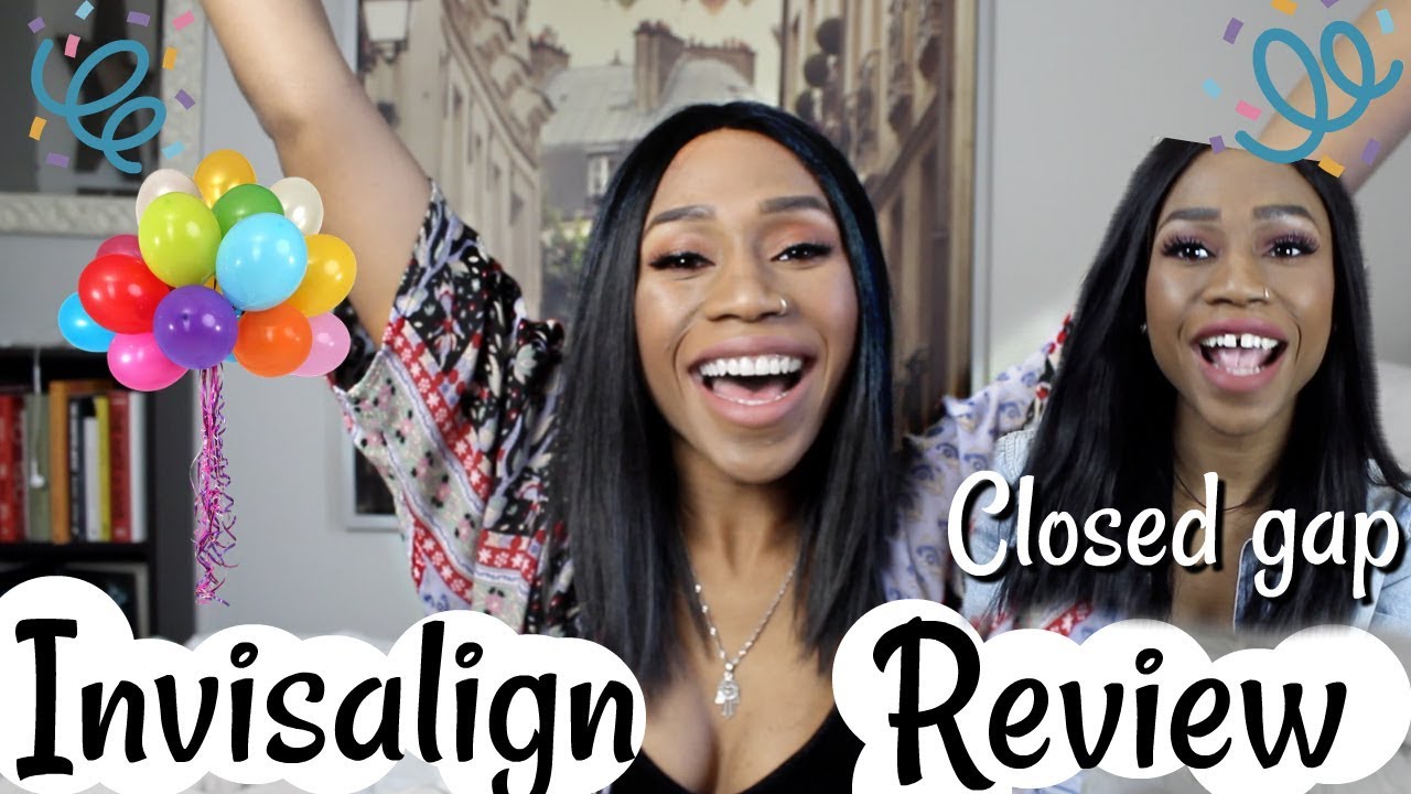 I COMPLETED MY INVISALIGN! (almost) EVERYTHING YOU NEED TO KNOW | Regina Ramos