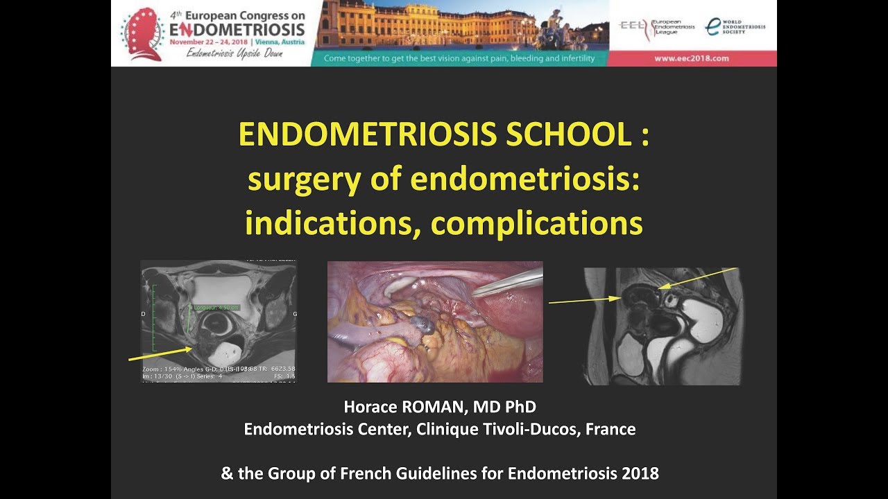 European Endometriosis League Congress: 