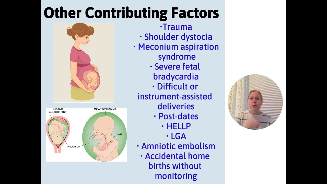 HIE and Cooling for the NICU Nurse