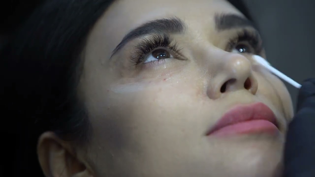 Göz Altı Morlukları ve Leke Tedavisi Uygulaması - Prof. Dr.  Banu Çaycı - Xela Rederm