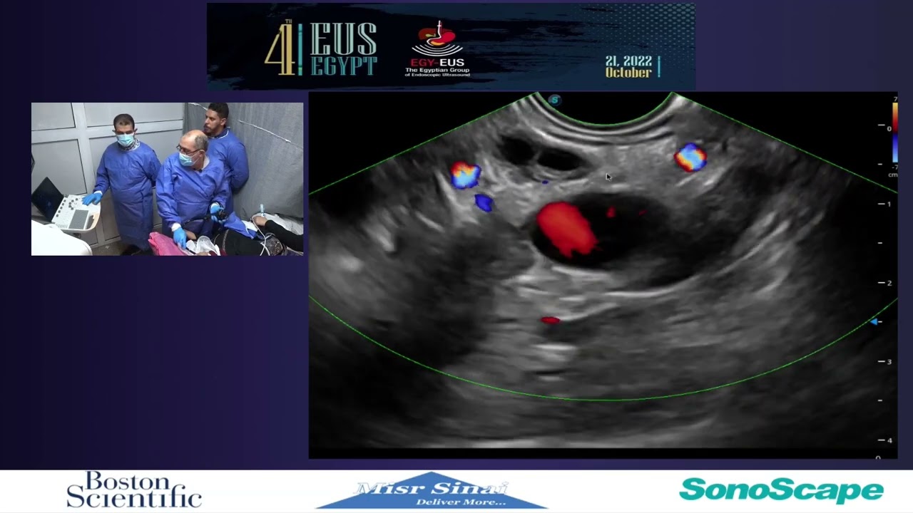 4th EUS Egypt   Linear EUS Examination of the Pancreas From the Duodenum