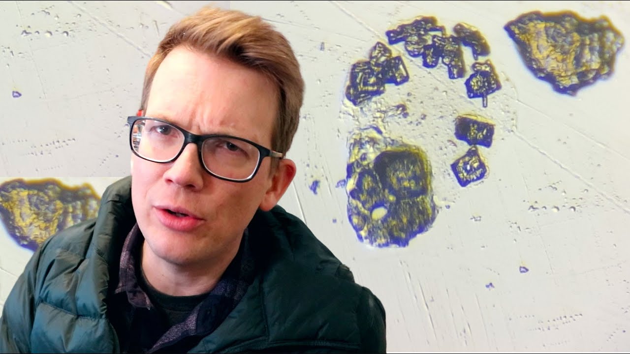 I Didn't Clean My Glasses for a Week and then I Put them Under a Microscope