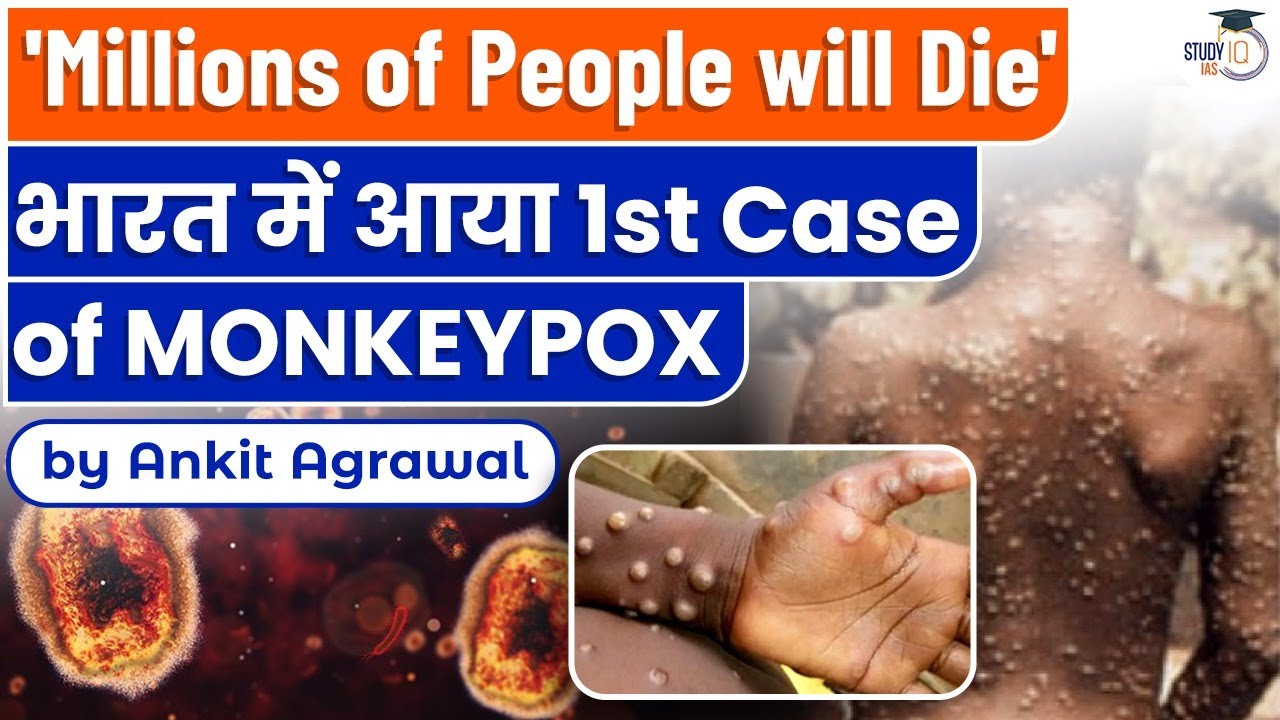 India's first Monkeypox case reported from Kerala, Kerala on high alert | Know all about it | UPSC