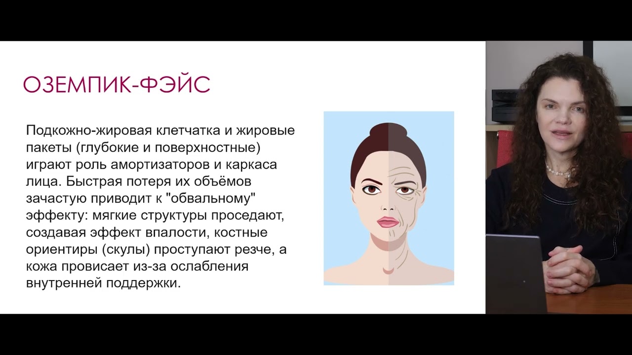 Королева  Оземпик