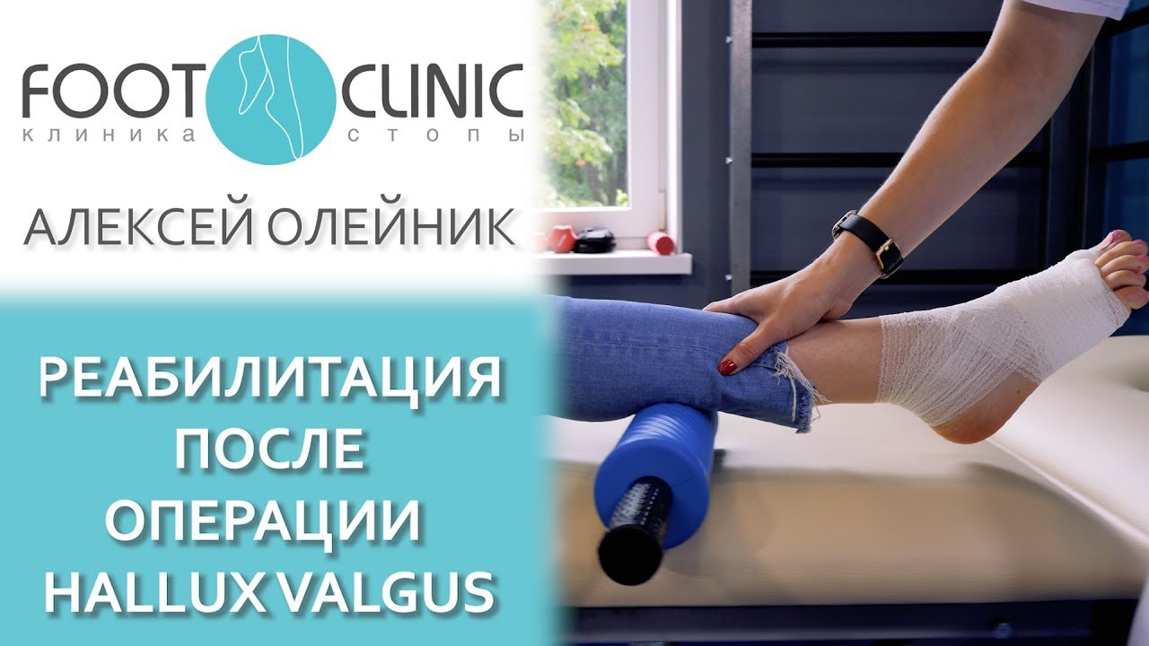 Что еще нужно делать после операции #halluxvalgus?