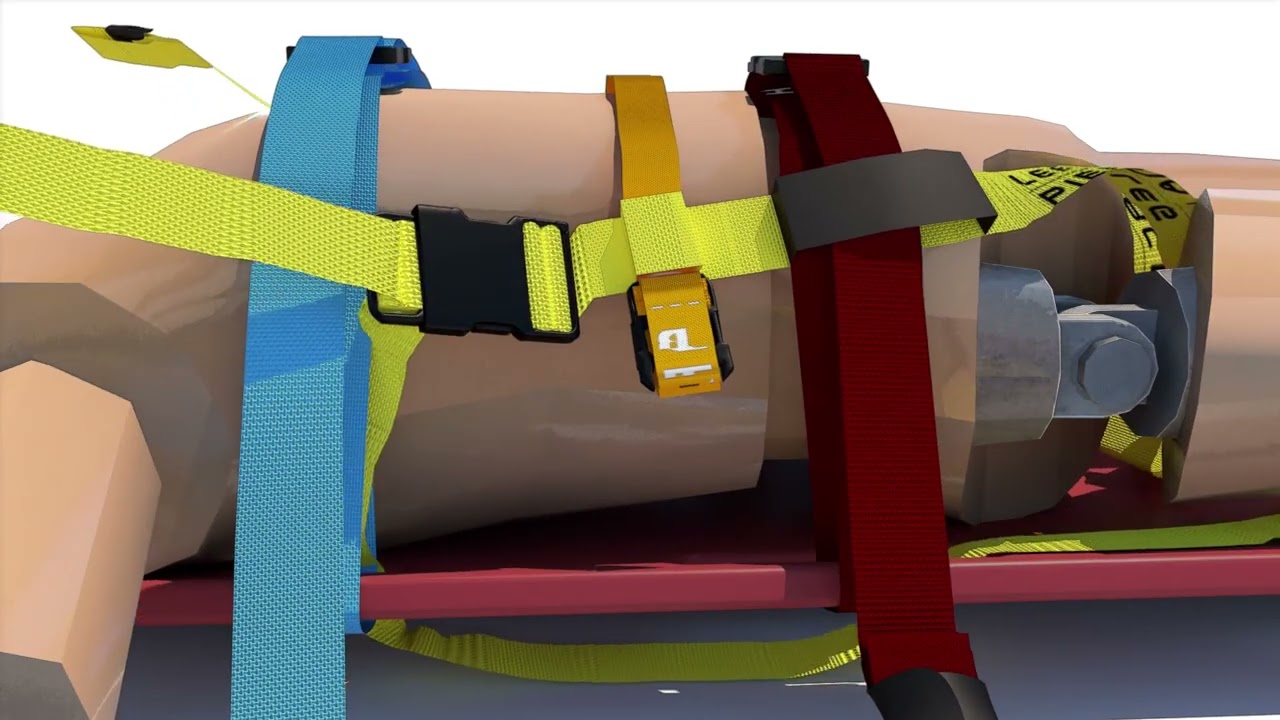 Octopus Rescue System