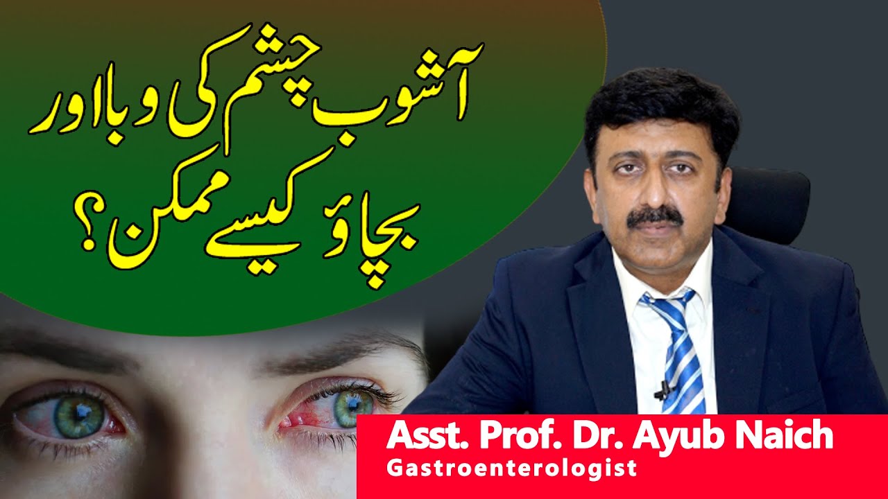 How is it possible to prevent the epidemic of eye infection | Naich GI Liver Clinic