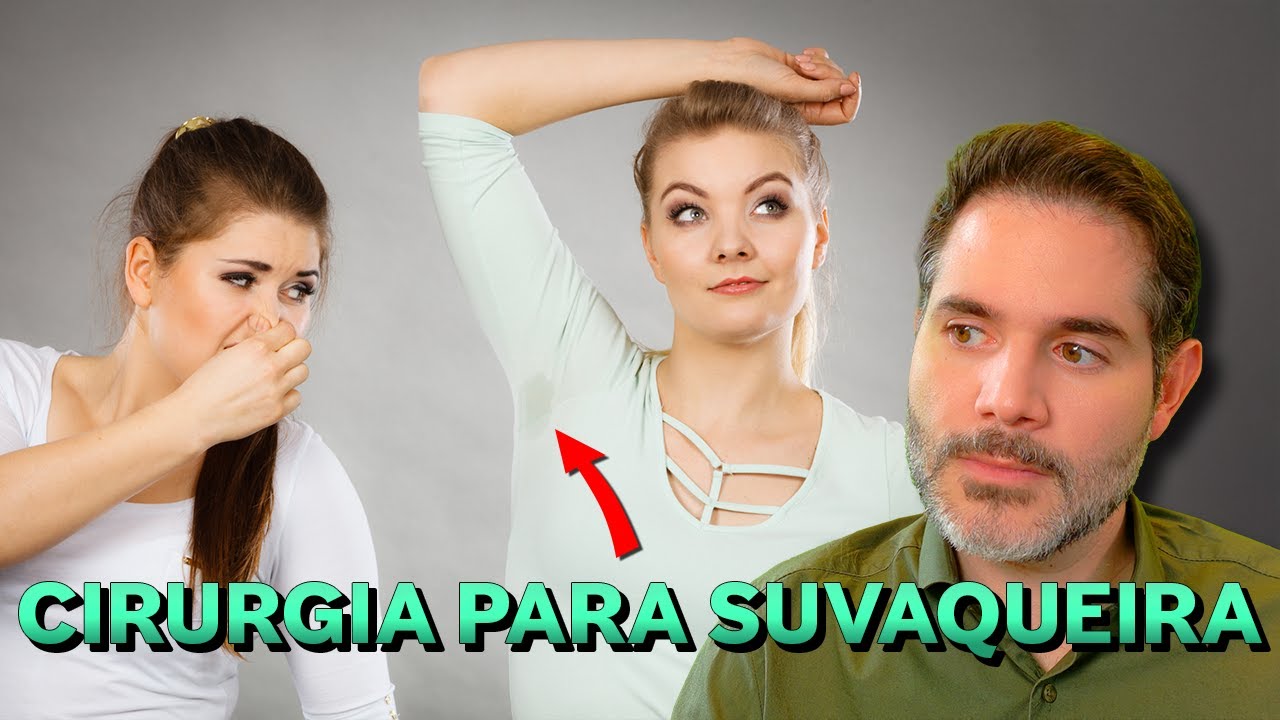 Simpatectomia RESOLVE BROMIDROSE (Cecê da axila)? Descubra os Mitos e Verdades