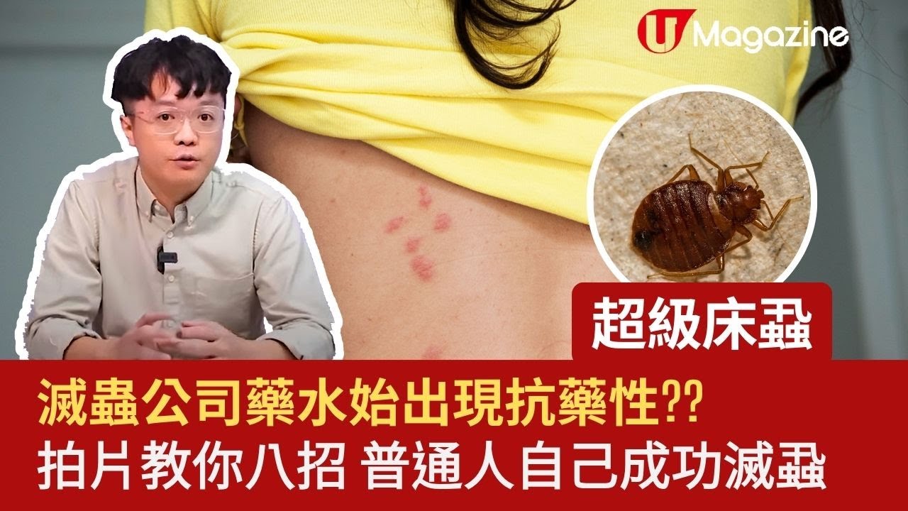 傳媒訪談 | 唔駛搵滅蟲公司！ 滅蟲佬教你8招滅床蝨木蝨！