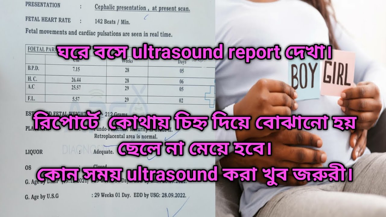 ঘরে বসেই নিজের ultrasound report দেখা।কোন সময় আলট্রাসাউন্ড করা খুব বেশি জরুরী #sampaarfiavlog।