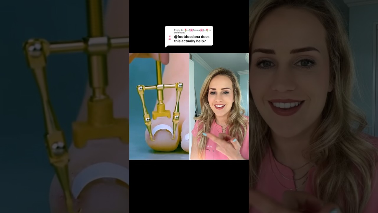 Could this cure ingrown toenails?!