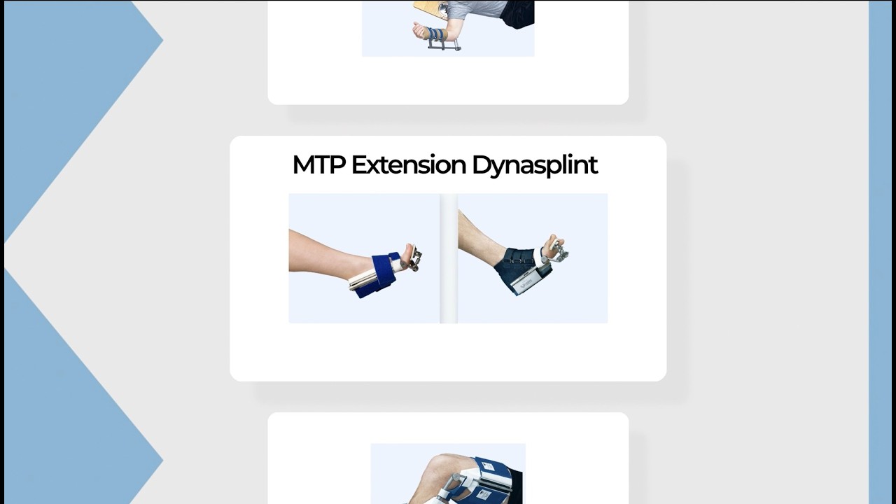 MTP Extension Dynasplint Fitting VIdeo