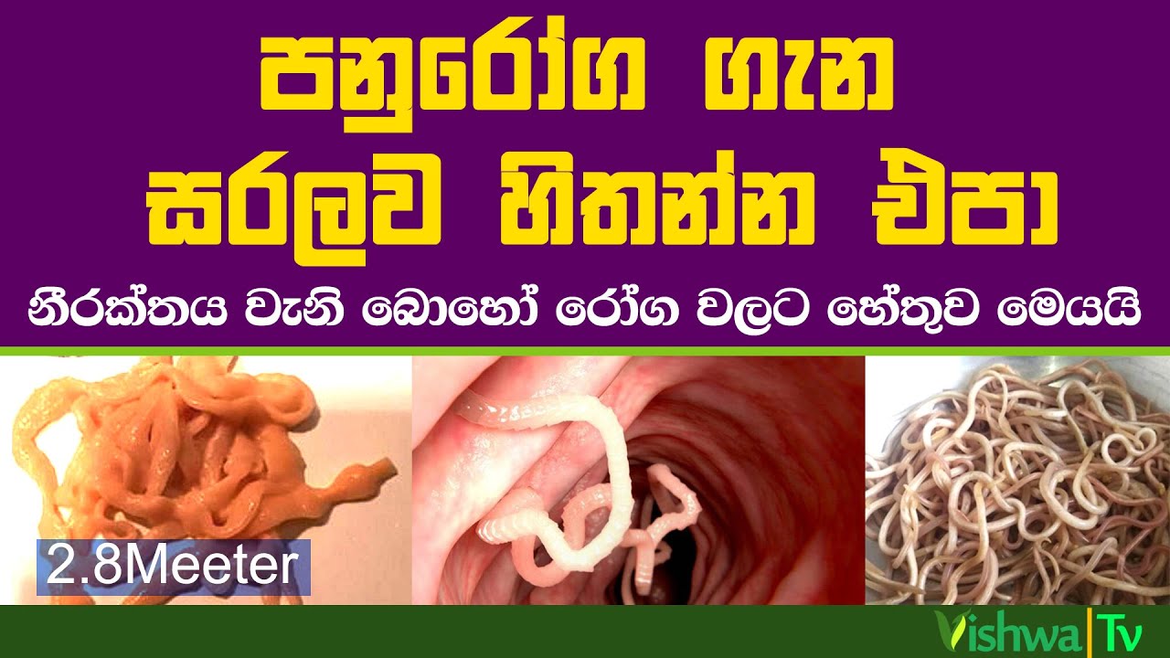 Natural Ways To How to  Rid Of Intestinal Worms (Panuroga) පනුරෝග සඳහා ආයුර්වේද ප්&zwj;රතිකර්ම