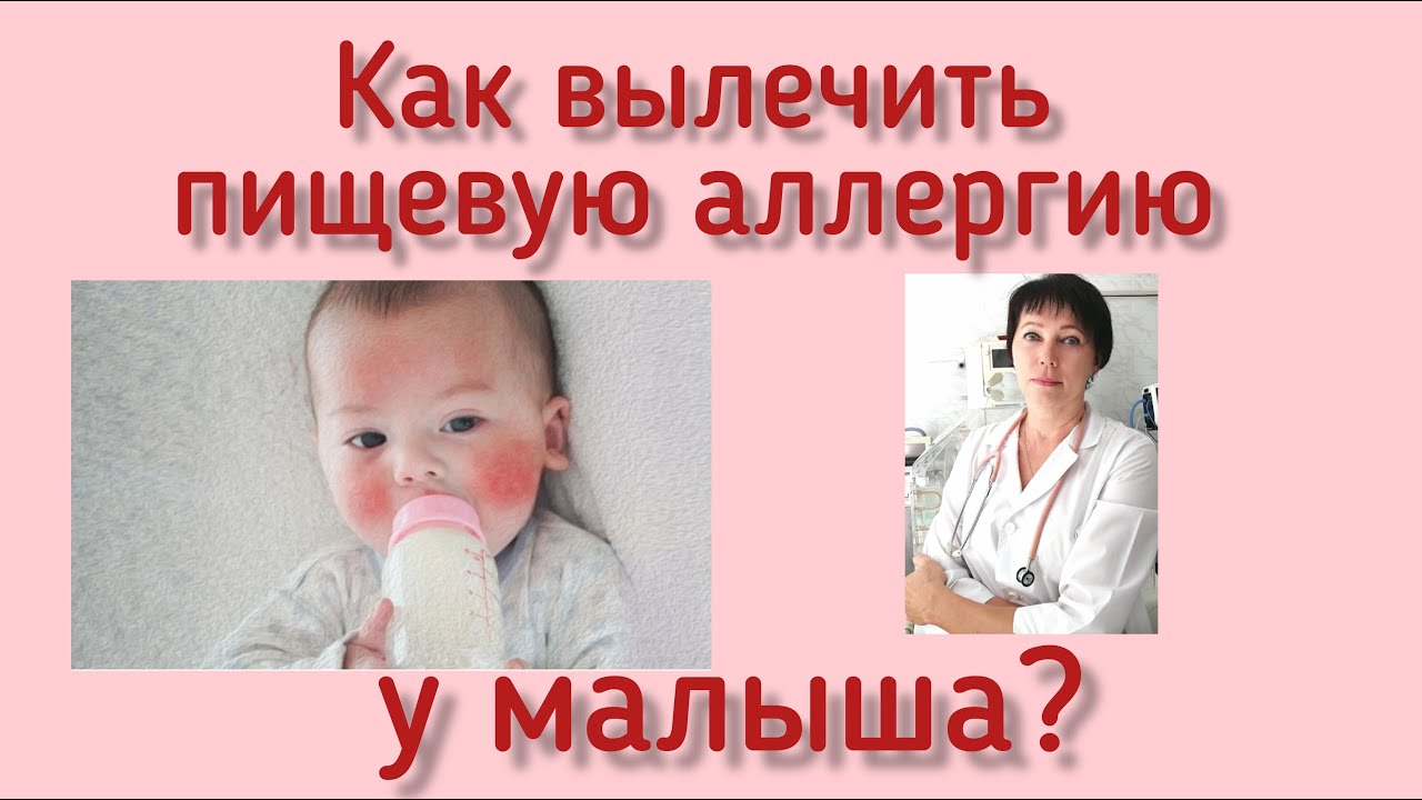 Как лечить пищевую аллергию у малыша?