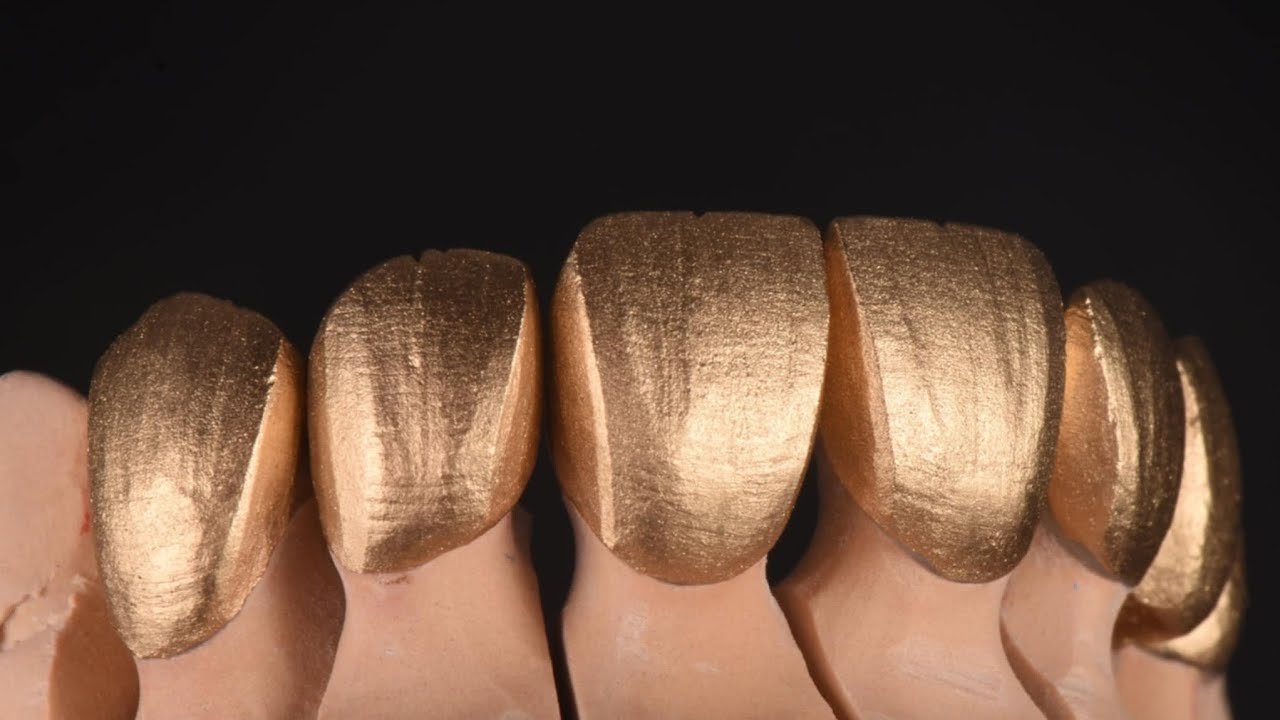 Dental Zirconia layered crowns & implant Trimming Anatomy