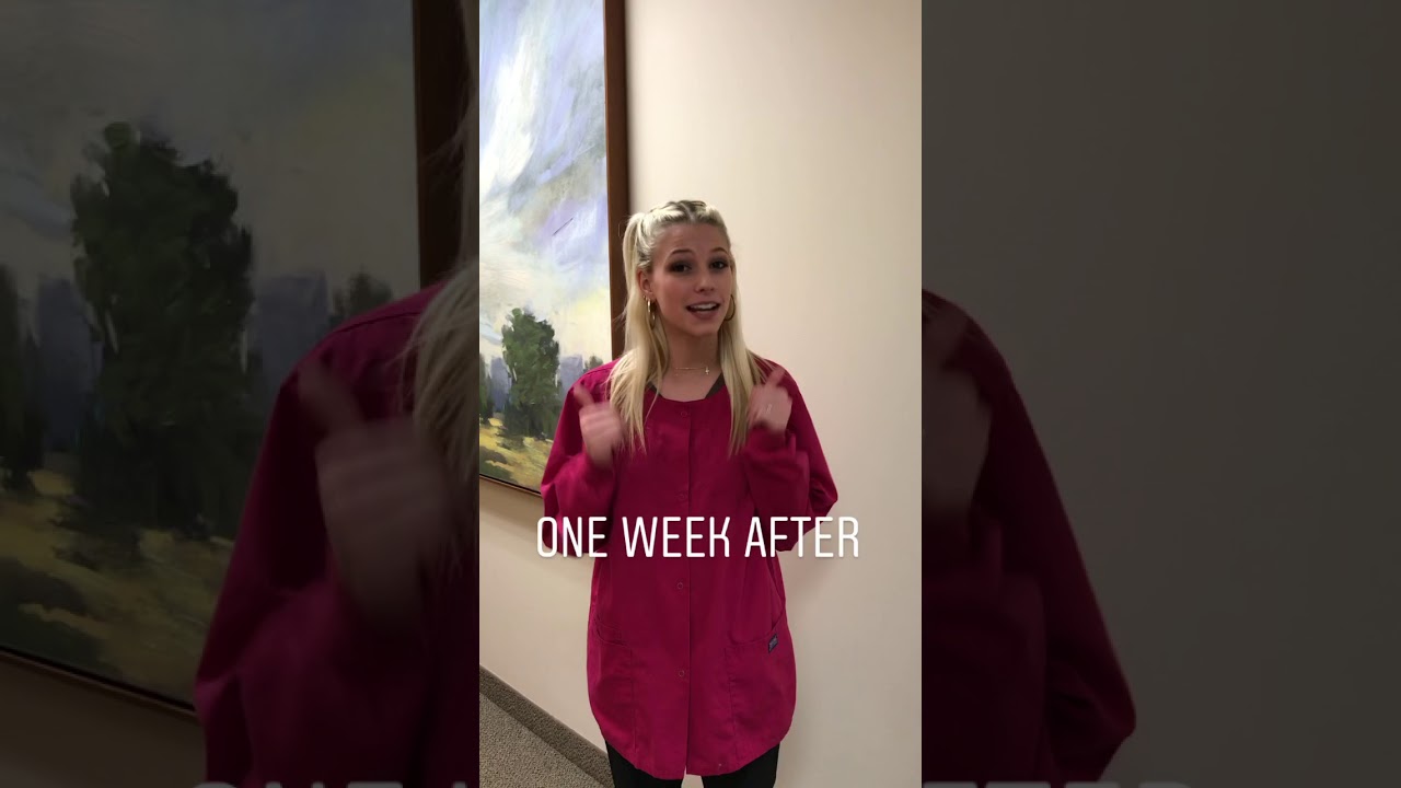 GUM GRAFT RECOVERY: 1-WEEK POST-OP EXPERIENCE 🌟🩹
