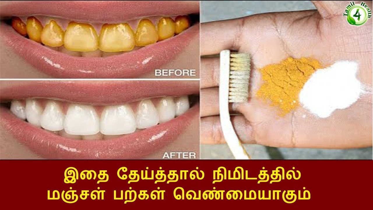 ஐந்து நிமிடத்தில் மஞ்சள் பற்கள் வெண்மையாகும்  இதை தேய்த்தால் | Magical Teeth Whitening