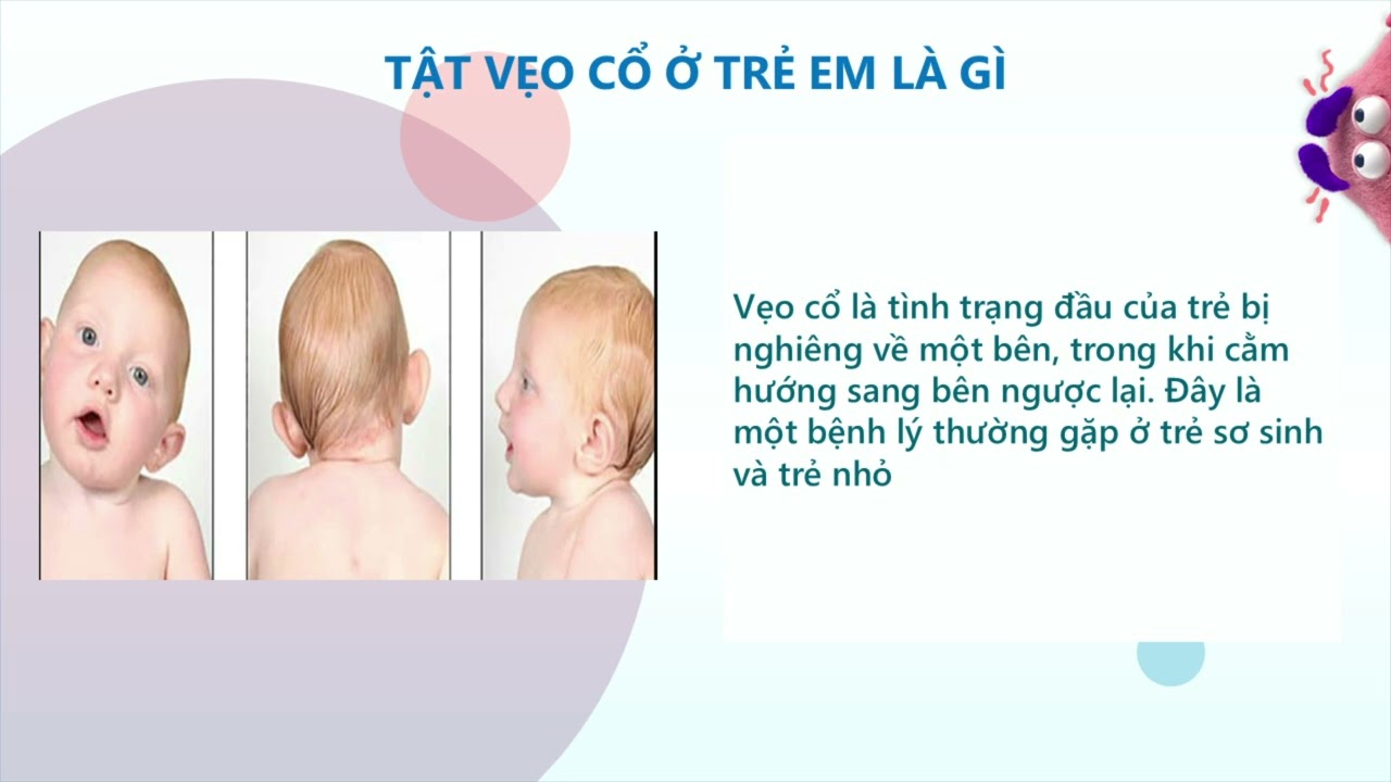 CÁC TẬT HÌNH THỂ THƯỜNG GẶP Ở TRẺ