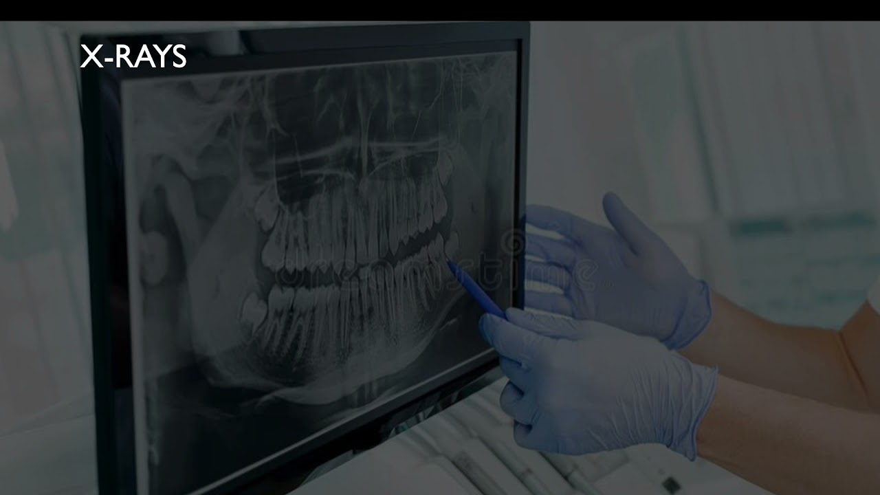 Radiography Refresh