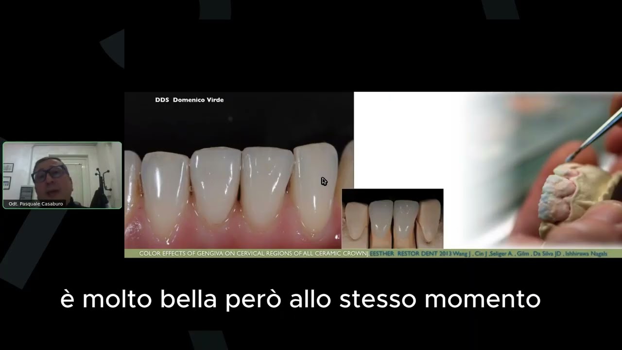 HeraCeram cre-active, per un risultato estetico di livello superiore - Odt. Pasquale Casaburo