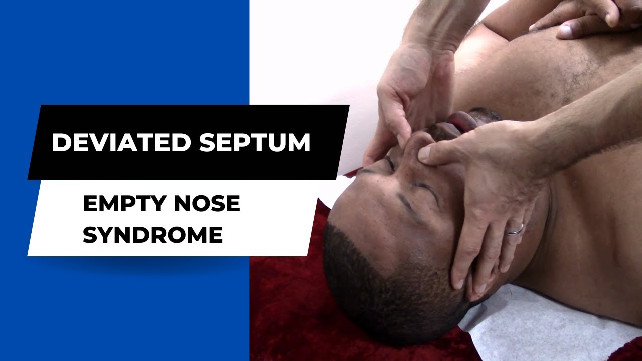 Deviated Septum, Empty Nose Syndrome, Maxillary Sinus HELPED Dr Suh Gonstead Chiropractic NYC