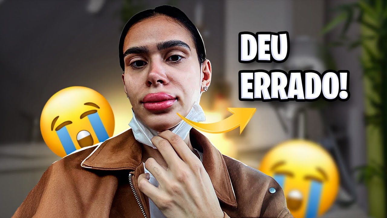 DEU ERRADO MEU PROCEDIMENTO EST&Eacute;TICO