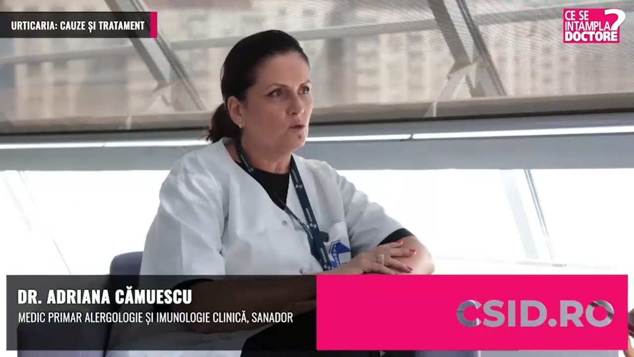 Urticaria – Dr. Adriana Cămuescu | SANADOR