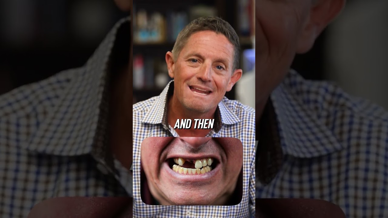 Suboxone Lawsuit: Shocking Tooth Loss Side Effects Revealed