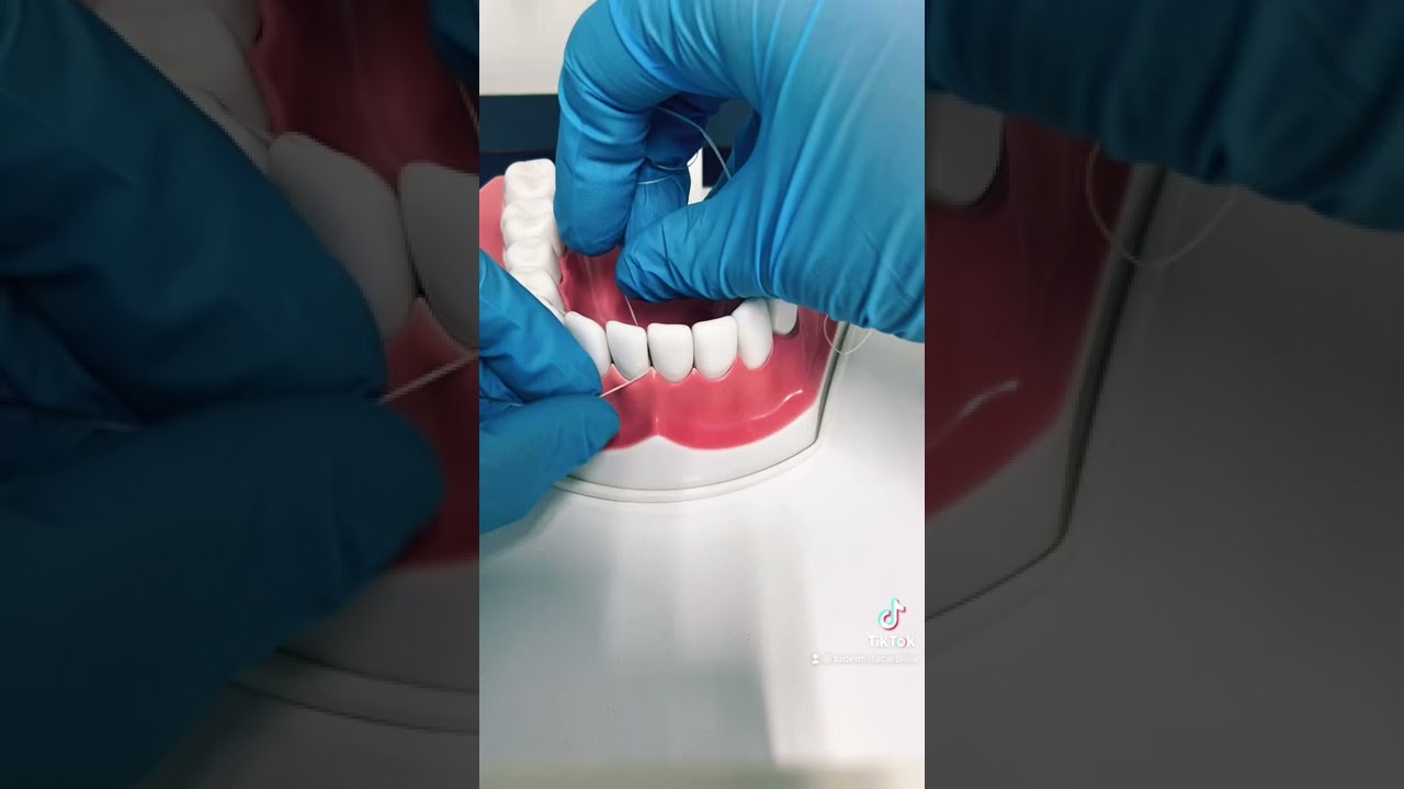 &iquest;C&oacute;mo usar hilo dental correctamente?