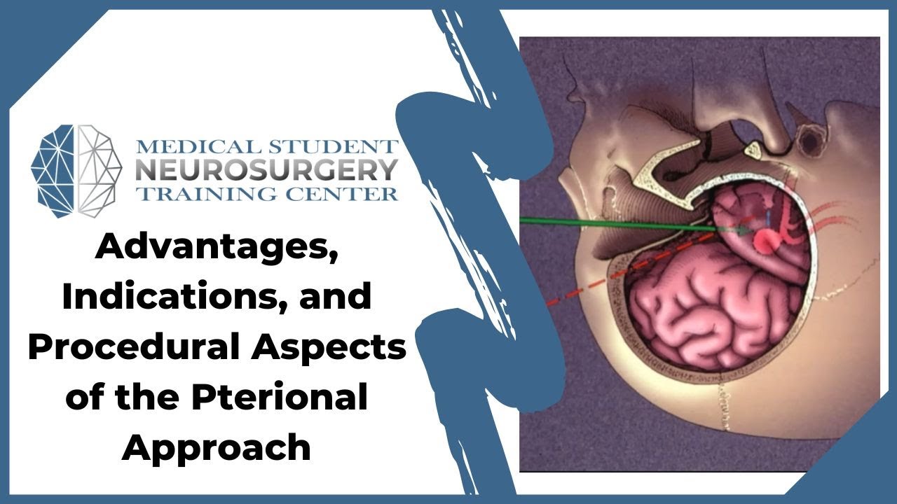 Advantages, Indications, and Procedural Aspects of the Pterional Approach