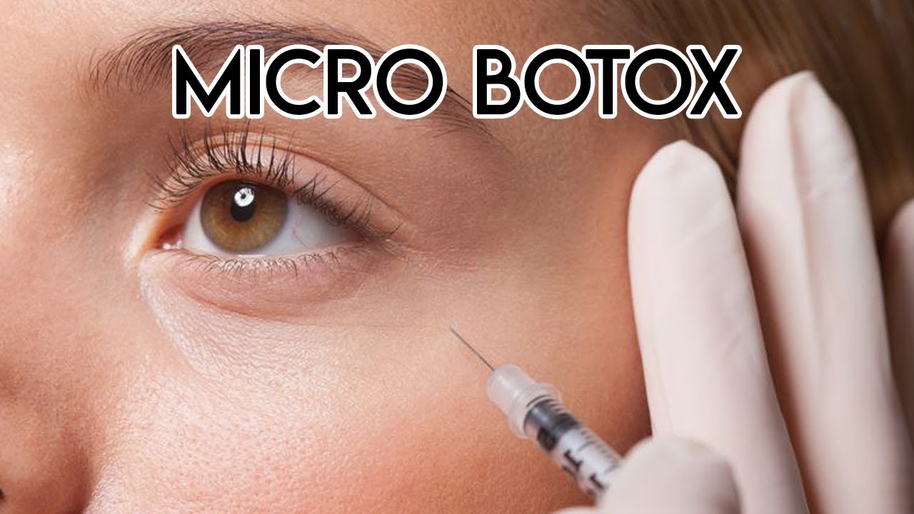 Micro Botox
